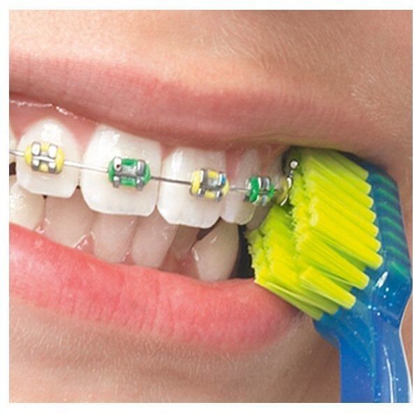 Curaprox Ortho Ortodonti 5460 Diş Fırçası